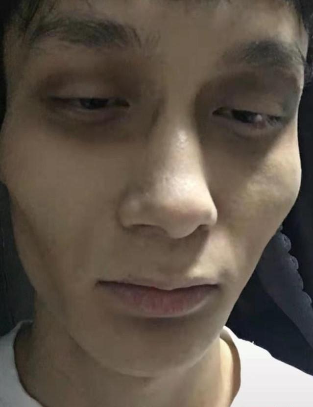 详细阅读:虚弱 虚弱
