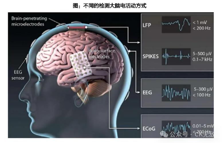 详细阅读:脑机接口:开启人机融合的新时代 脑机接口:开启人机融合的新时代
