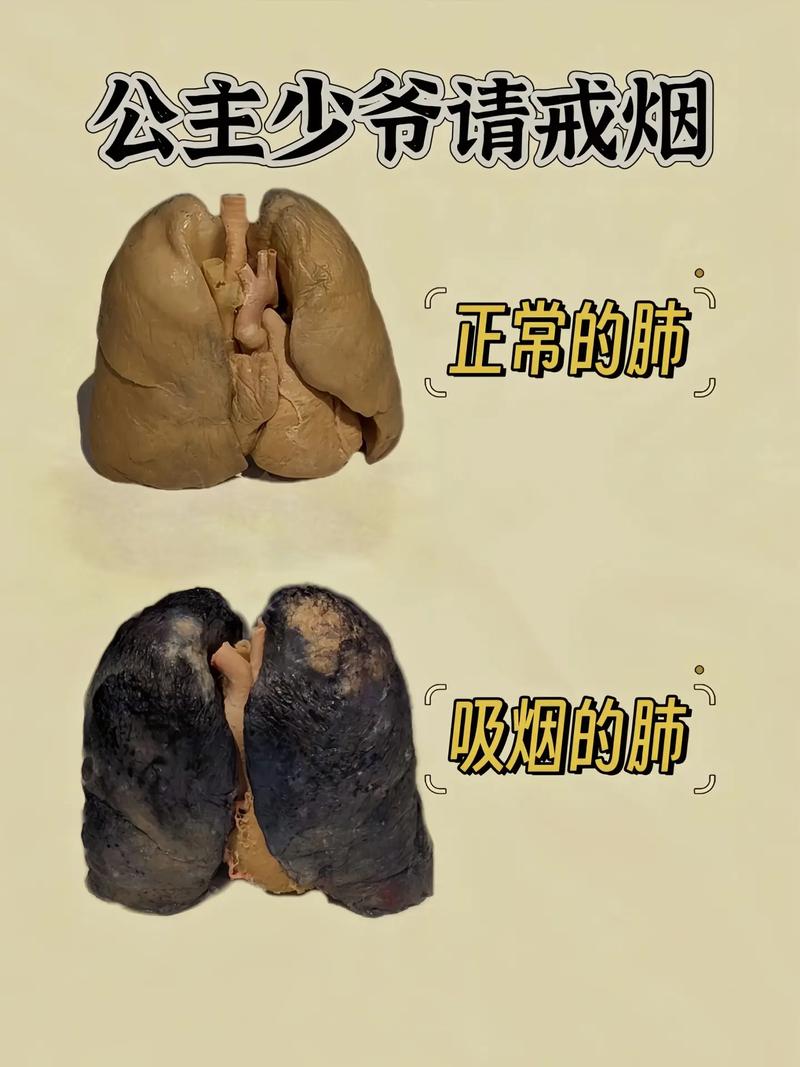 吸烟对皮肤的危害：不可忽视的“美丽杀手”
