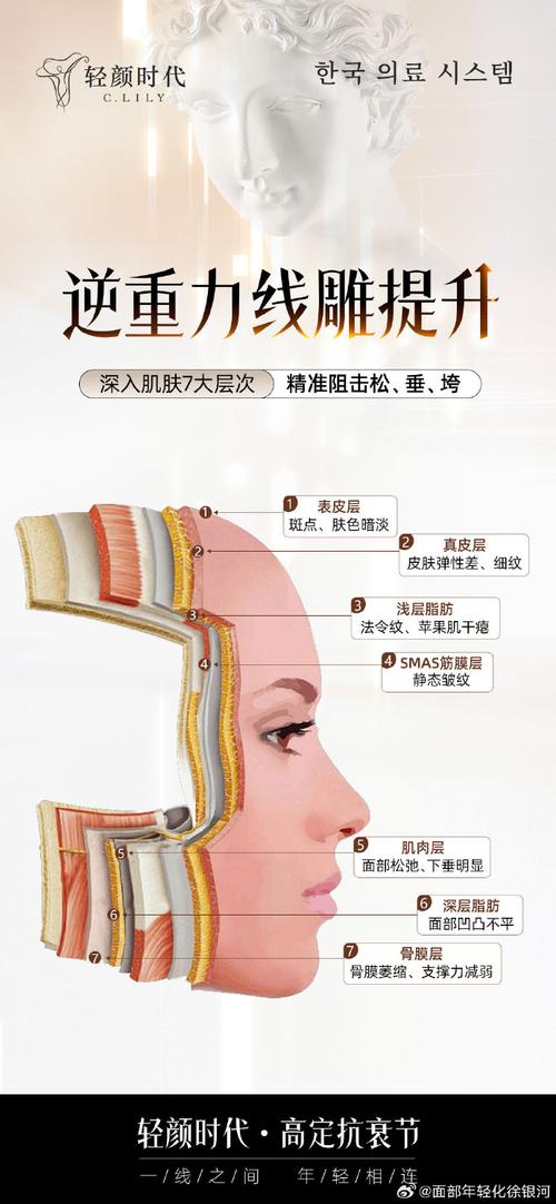 线雕美容介绍