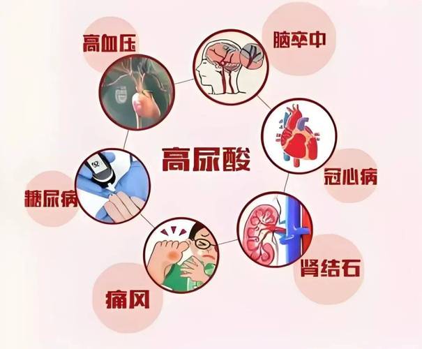 尿酸：代谢、影响与健康管理