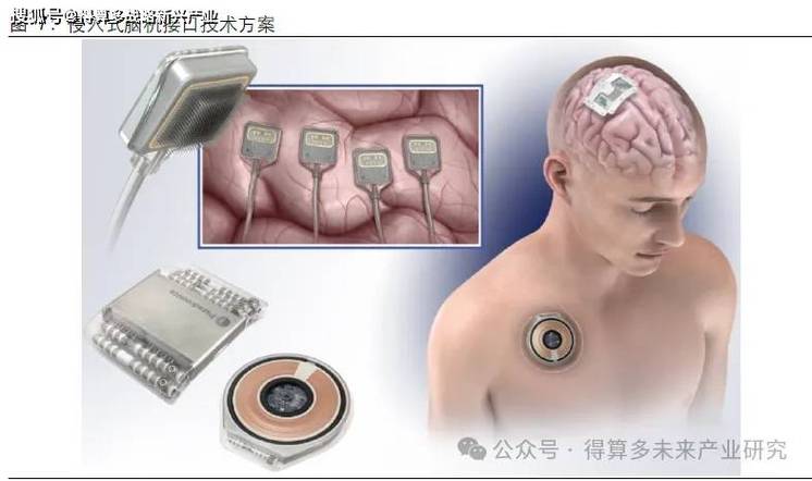 详细阅读:脑机接口技术:探索大脑与外部世界的新型交互方式 脑机接口技术:探索大脑与外部世界的新型交互方式