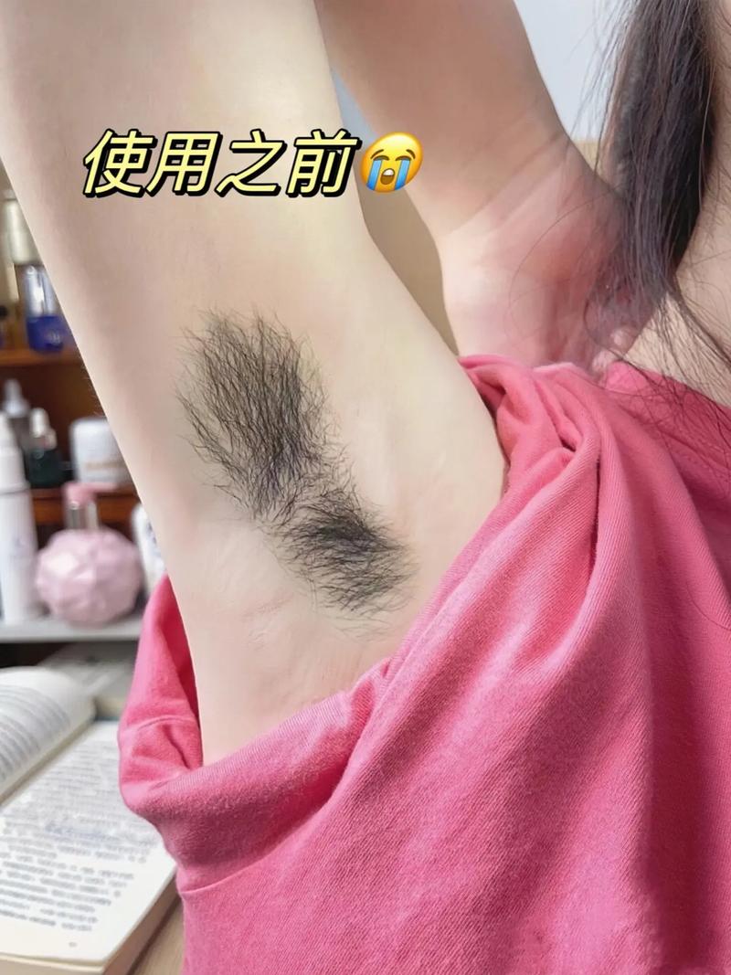 腋毛处理技巧全攻略