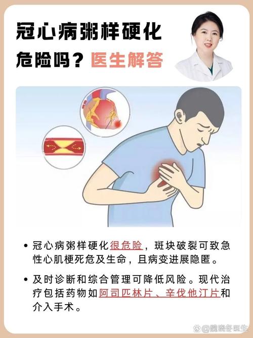 冠心病：隐匿的健康杀手