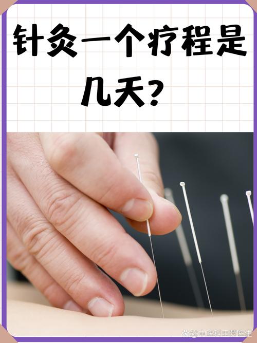 针灸：古老而神奇的中医疗法