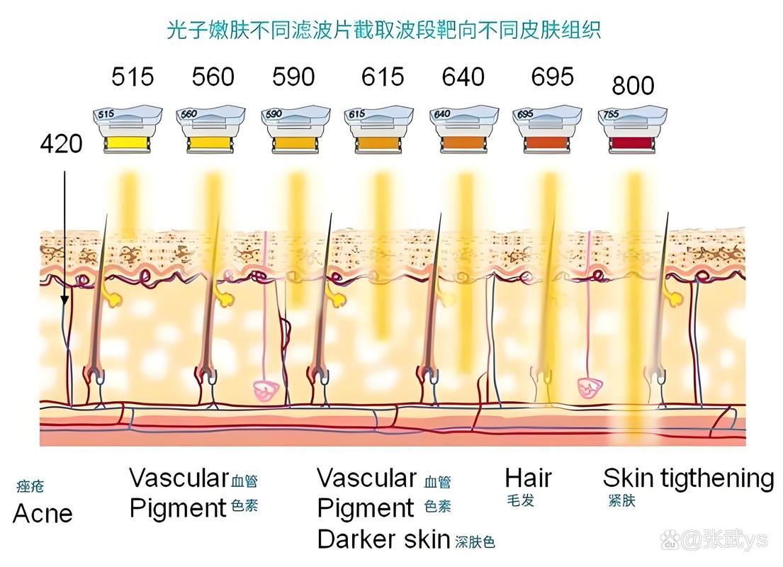 光子嫩肤仪：原理、效果全解析