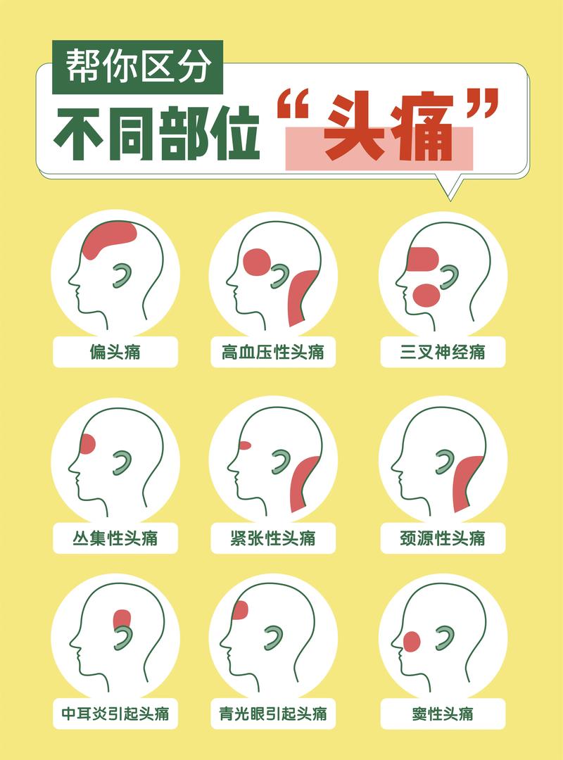 头痛：常见原因、症状与治疗策略