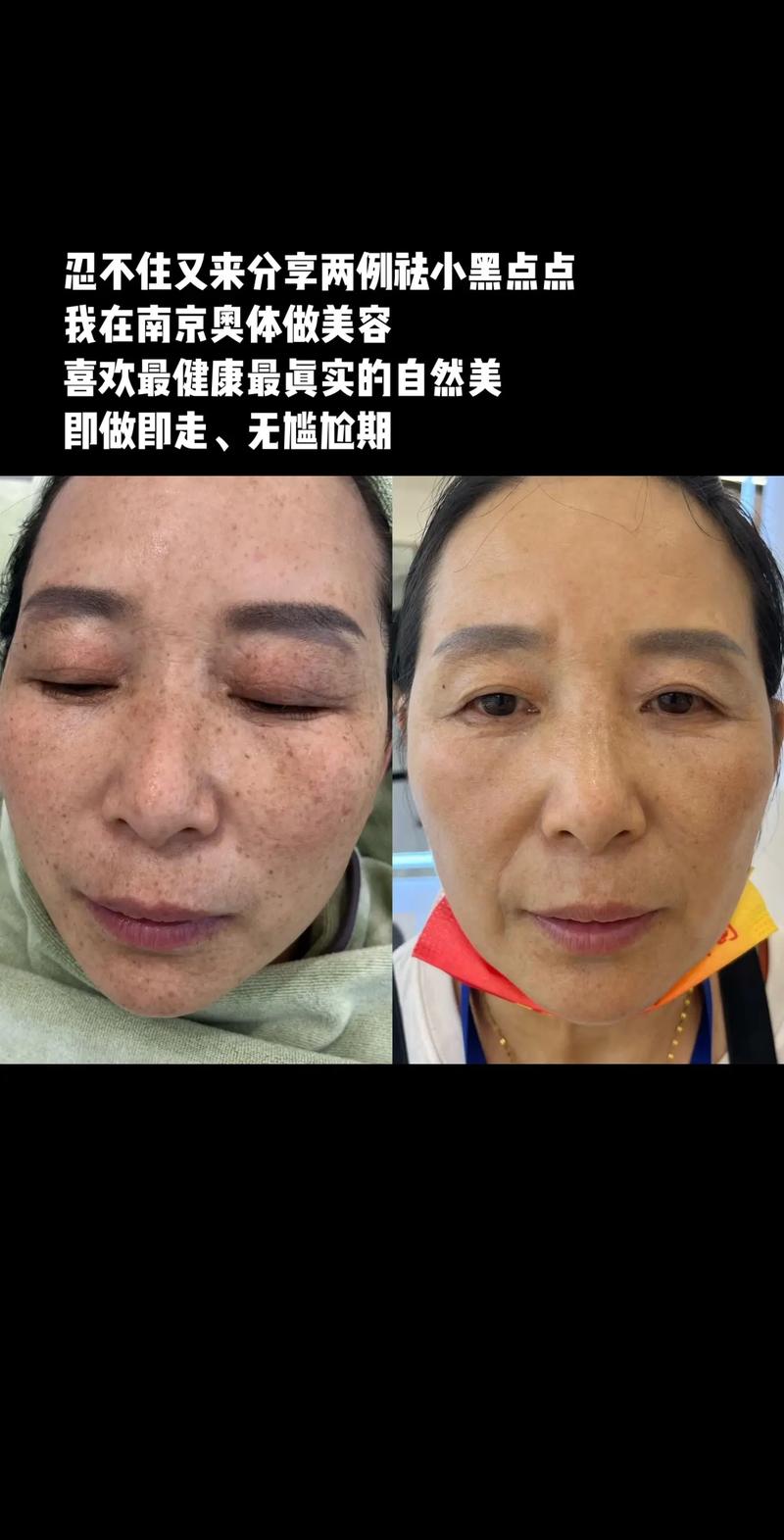 详细阅读:美容与社交生活:相互交织的多面影响 美容与社交生活:相互交织的多面影响