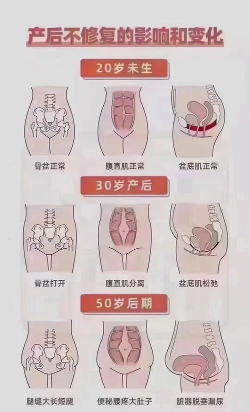 重塑健康体态，从产后骨盆修复带开始