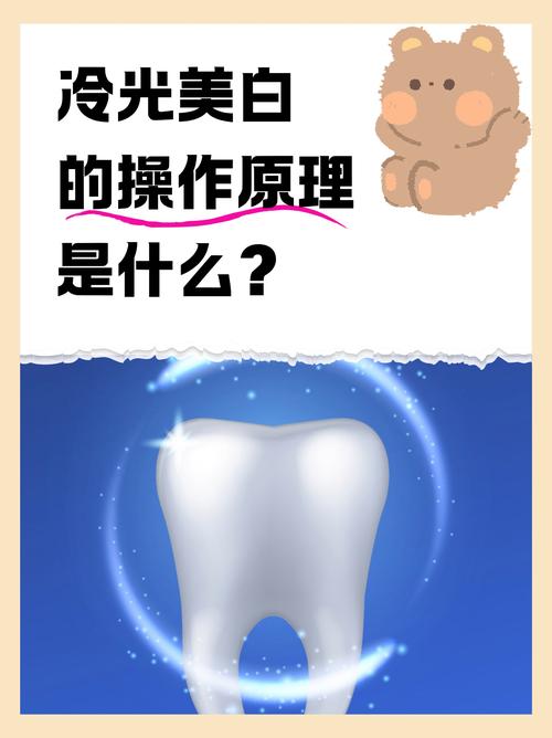 冷光美白牙齿原理与过程