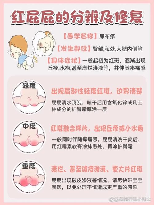 护臀膏的使用方法详解