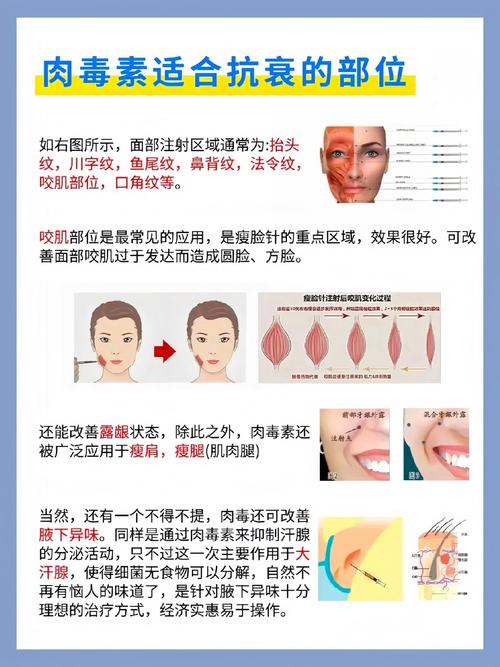 肉毒素除皱功效