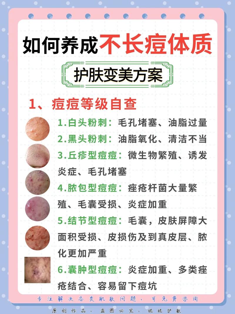 痘痘肌护理全攻略：从根源入手，重拾肌肤光滑