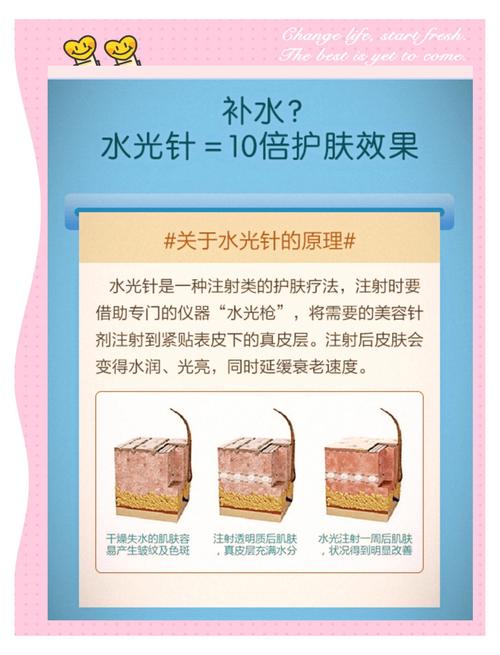 水光针与水光枪：美容护肤的双子星，揭秘其神秘面纱