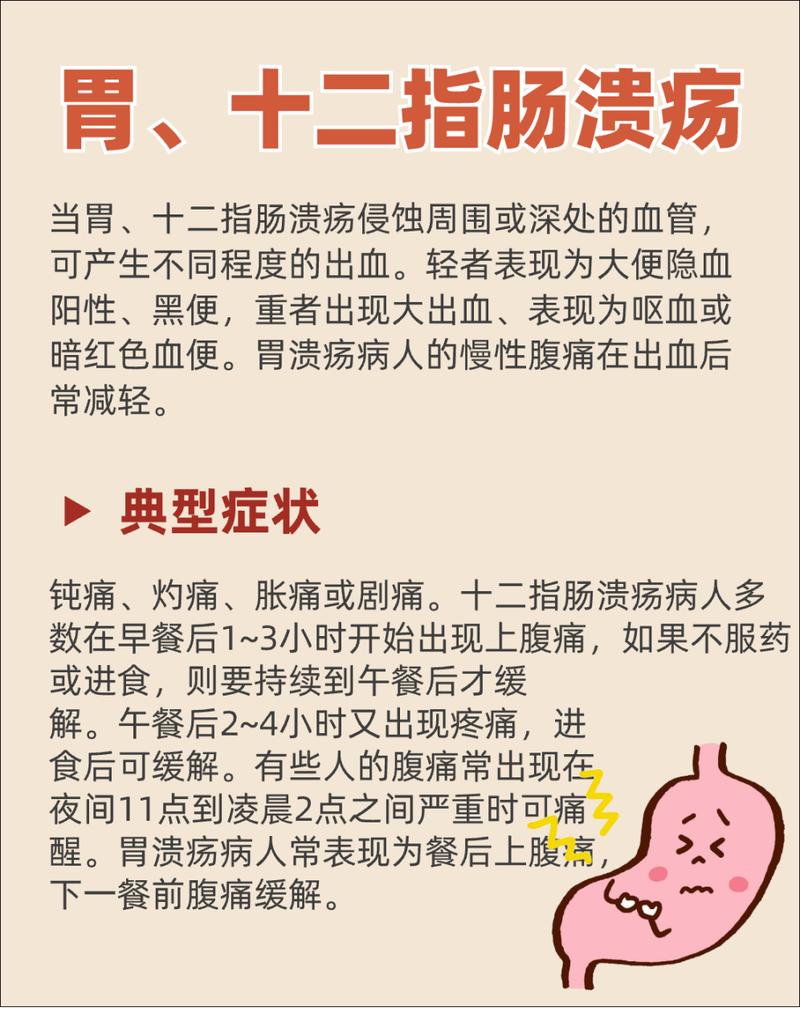 胃溃疡：病因、症状与治疗全解析