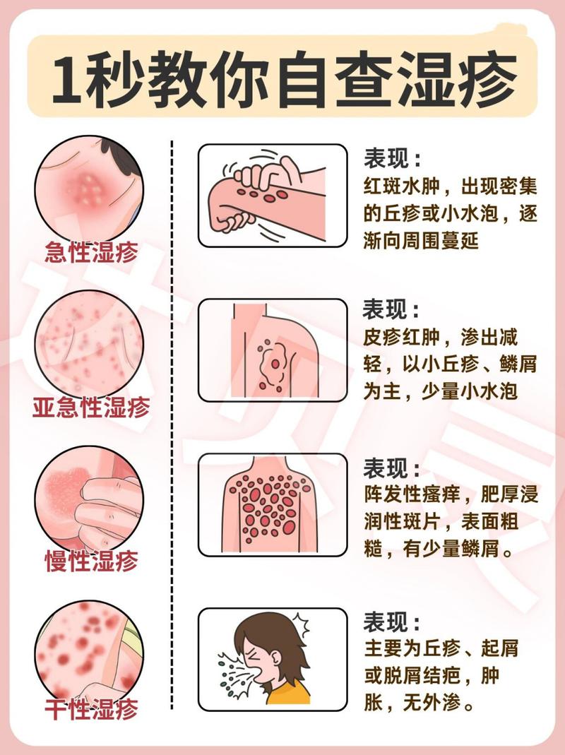 湿疹：全面解析与应对策略