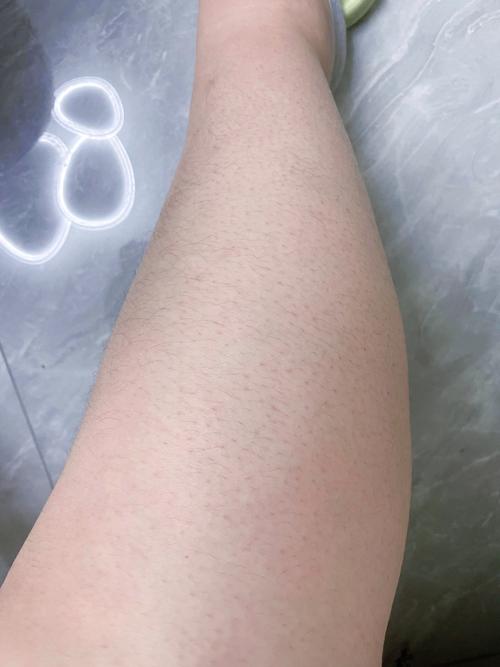 腿部脱毛全攻略：解锁光滑美腿的秘密
