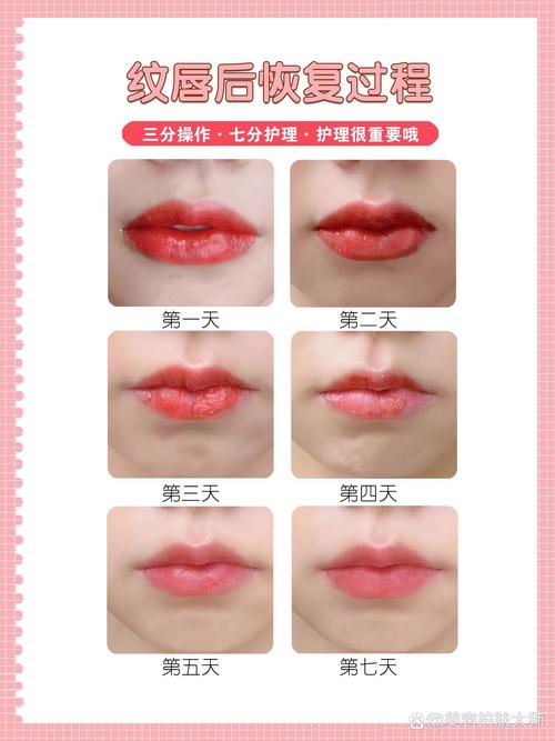 唇部肌肤修复：重绽唇间魅力与健康