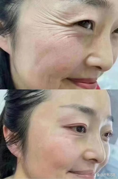 身体肌肤抗皱：守护年轻态的奥秘与实践
