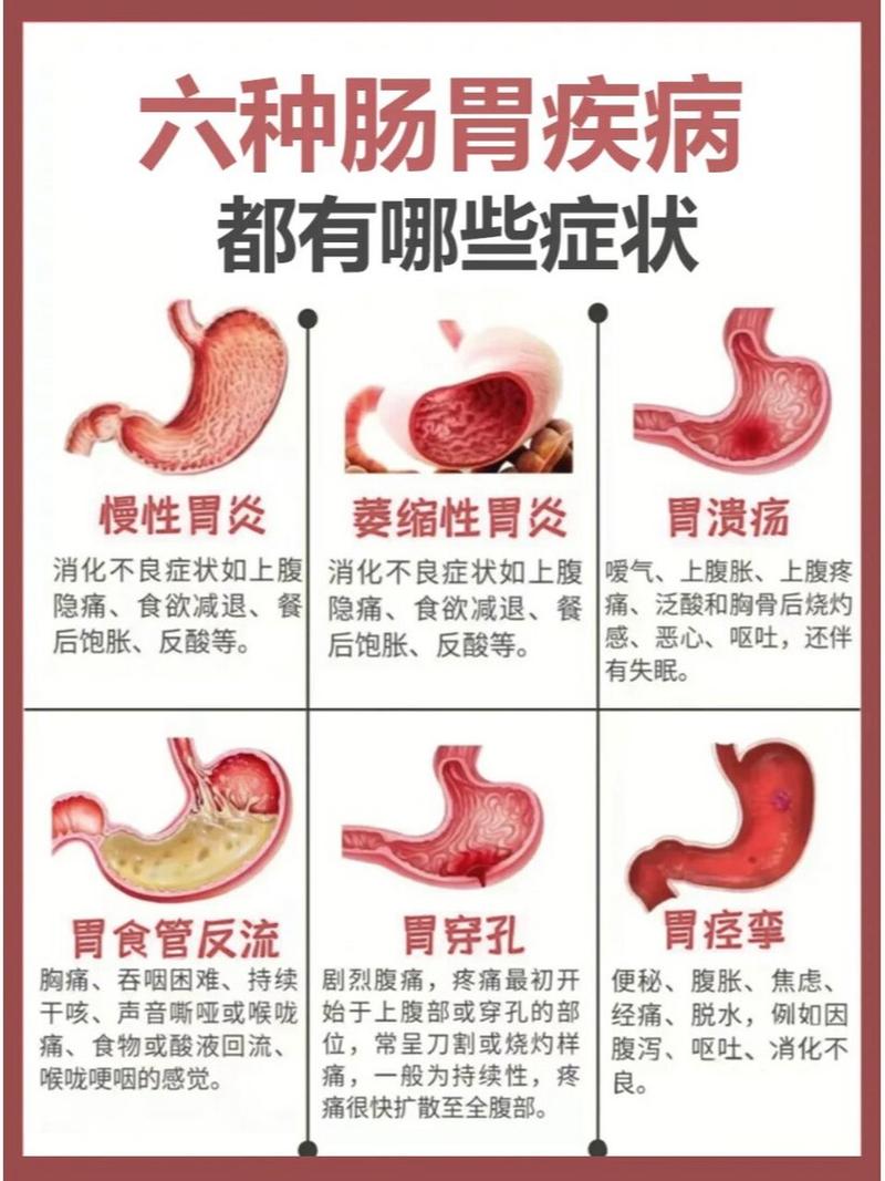 消化不良：成因、症状、诊断与应对