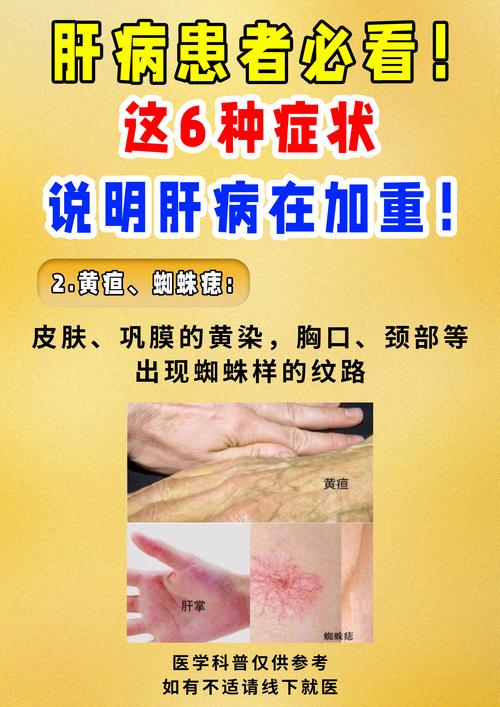 肝炎：警惕肝脏的“沉默杀手”