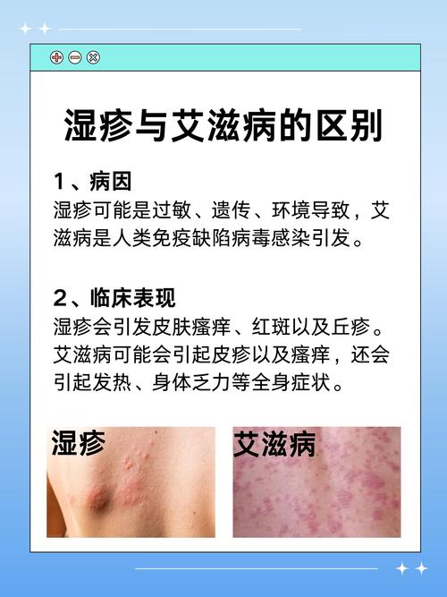 深度解析皮炎：成因、症状与综合应对策略