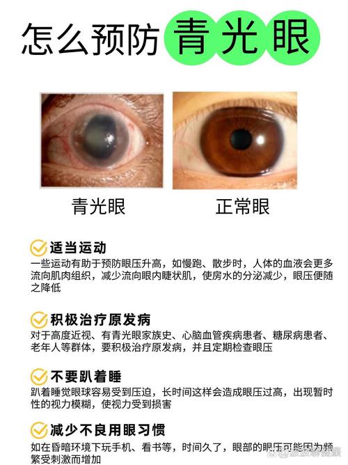 青光眼的治疗与预防