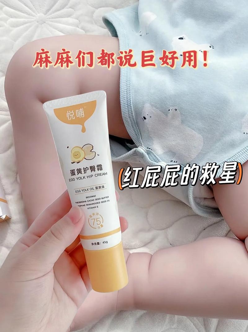 婴儿护臀膏：守护宝宝娇嫩屁屁的贴心卫士