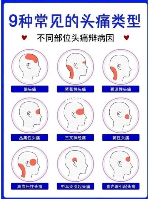 头痛：隐匿的健康“杀手”与破解之道