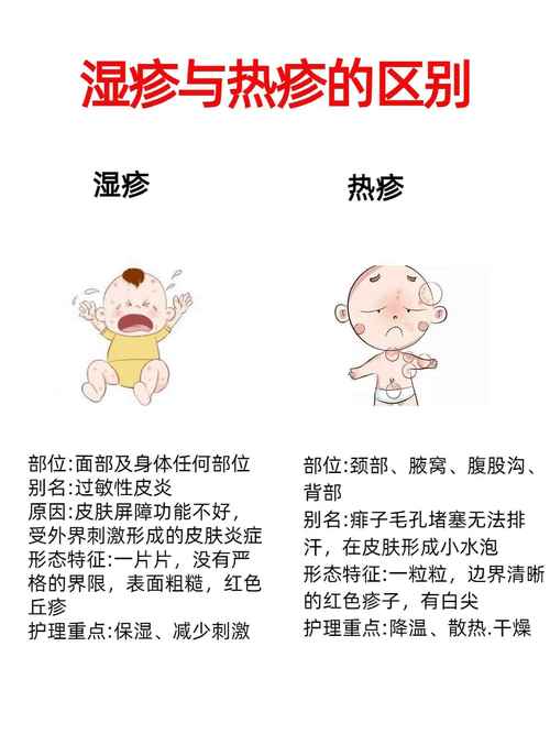 宝宝防湿疹全攻略：守护宝贝肌肤，远离湿疹困扰
