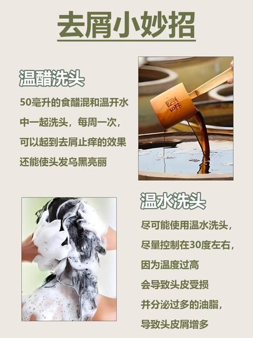 告别“雪花头”，重拾自信风采：全方位攻略助你摆脱头屑困扰