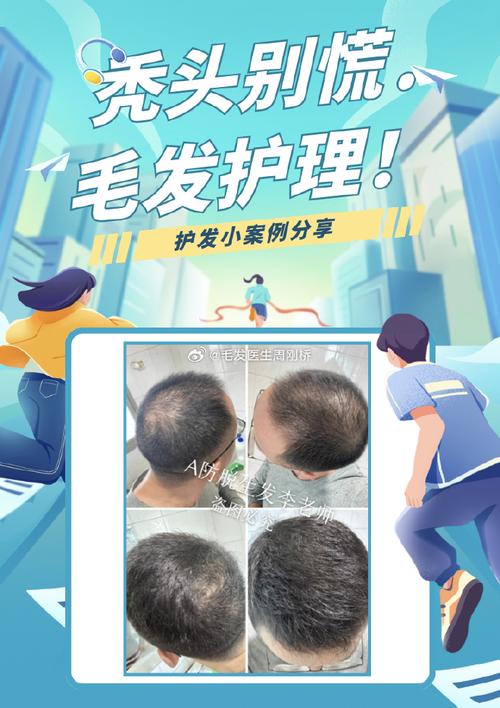 头发护理化学成分：从根源呵护秀发的秘密