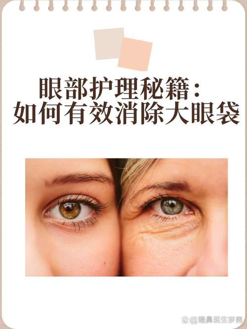 眼部护理方法全攻略：呵护心灵之窗，绽放明亮光彩