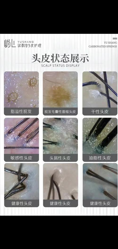 深度解析头发护理与头皮清洁产品：从根源焕活秀发活力