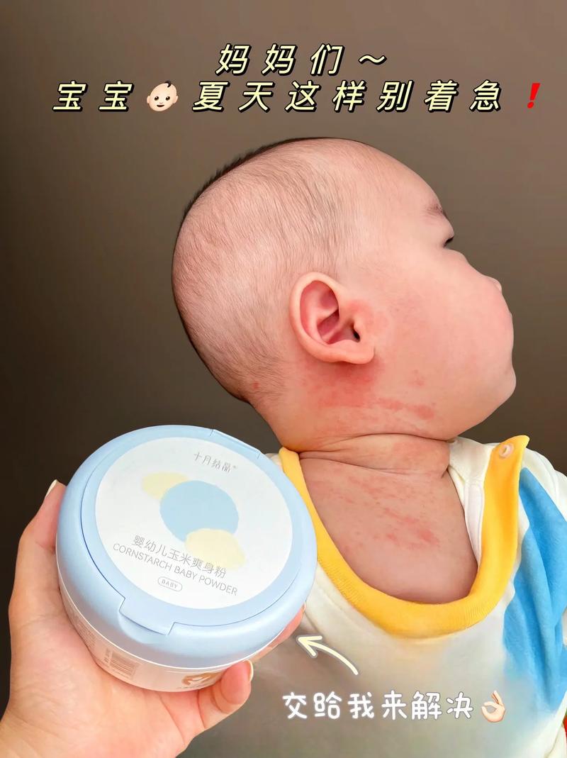 婴儿爽身粉：宝宝肌肤的贴心呵护者