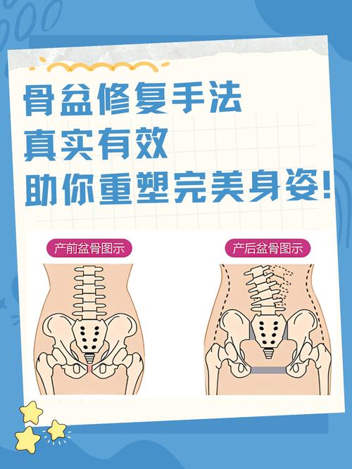 解锁产后修复秘密武器：骨盆带，助你重塑曼妙身姿