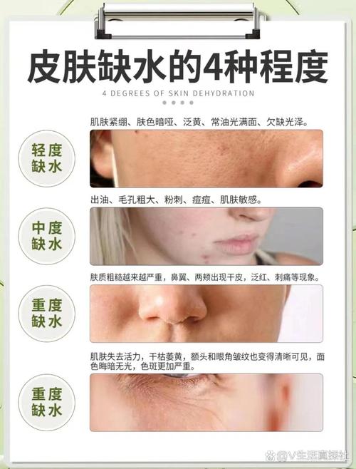 洗澡水温对皮肤的影响