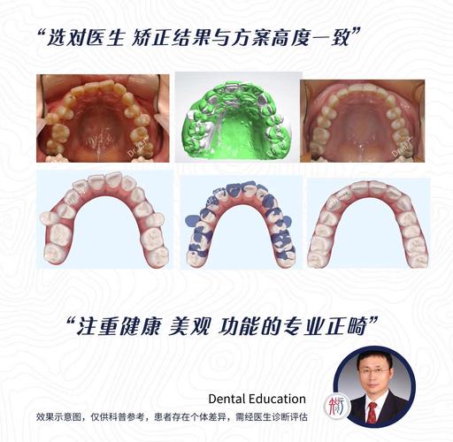 隐形矫正对容貌的深远影响：从牙齿到颜值的全面改变