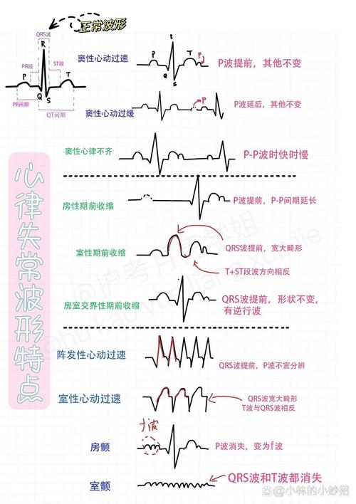 以下是关于心律失常的常见治疗方法的详细介绍：