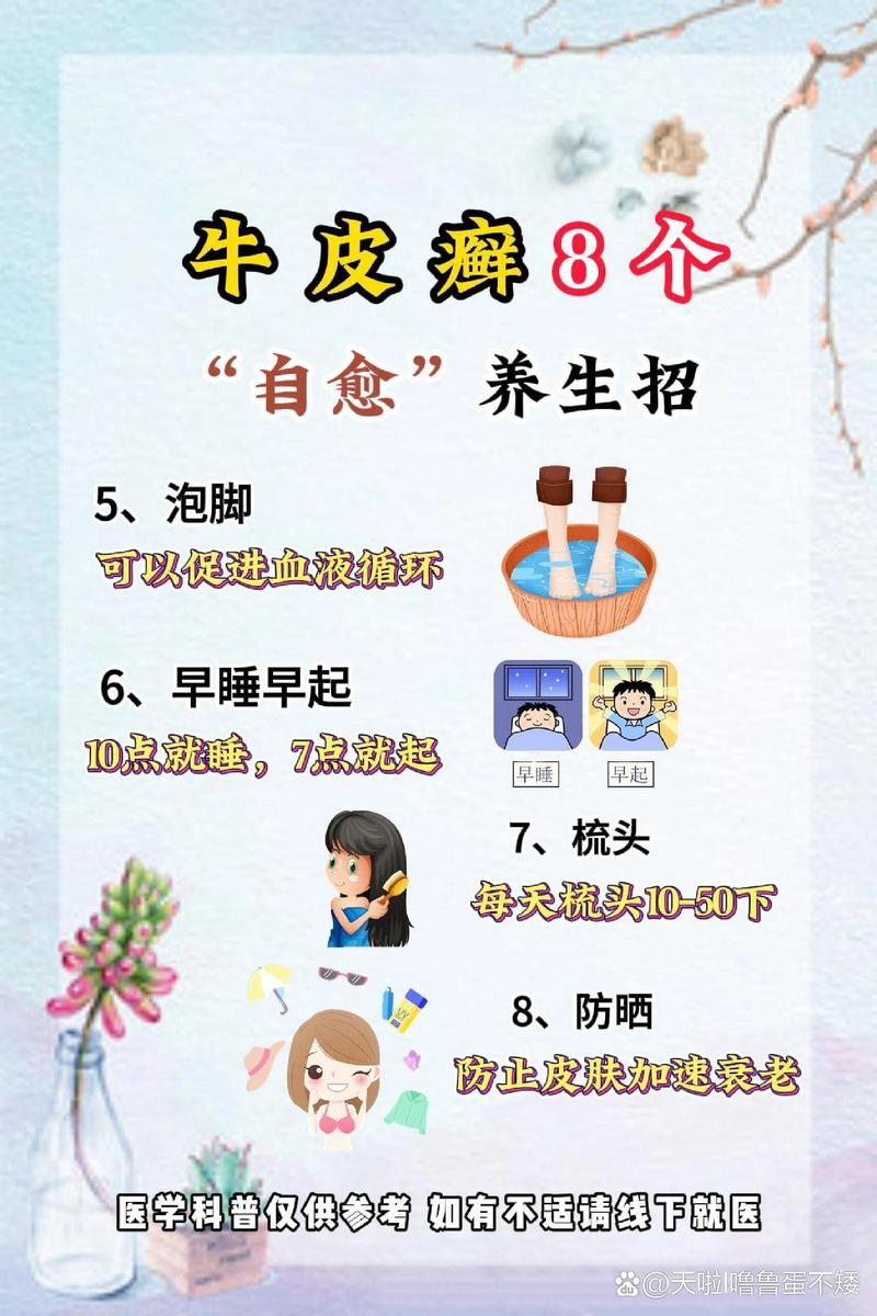 牛皮癣的治疗与控制