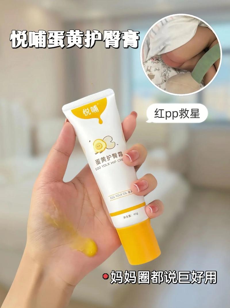 婴儿护臀膏：宝宝肌肤的贴心守护者