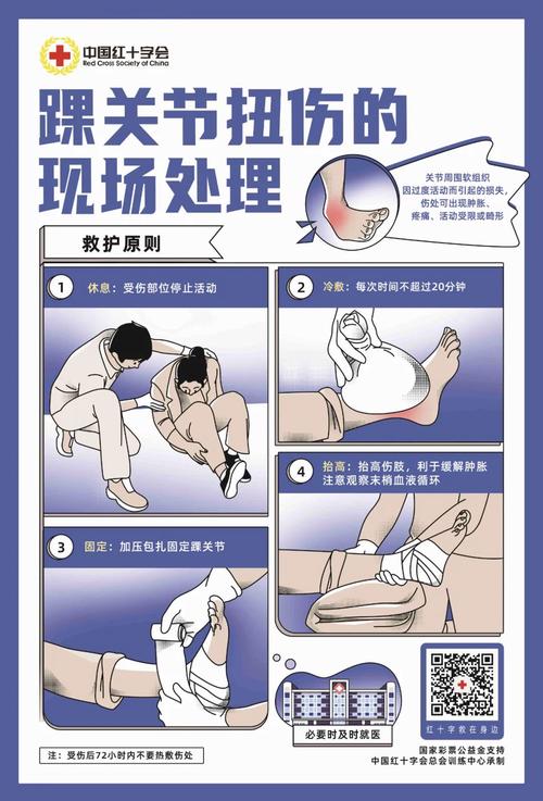 详细阅读:关节扭伤的科学处理指南 关节扭伤的科学处理指南