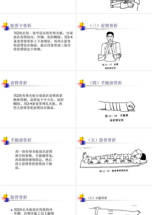 骨折的急救与固定：守护伤者的第一步