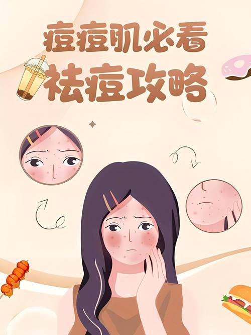 产后护理：科学应对祛痘困扰，重拾肌肤光彩