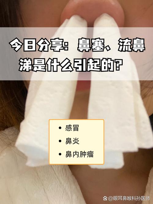关于流鼻涕：症状、成因、应对方法及预防措施的全解析