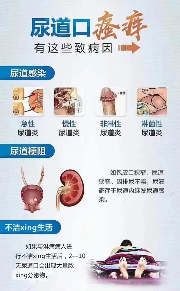 尿道炎——常见泌尿系统疾病的全面解析
