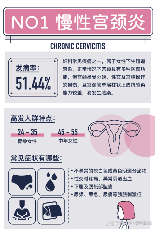守护女性健康：常见妇科疾病全解析
