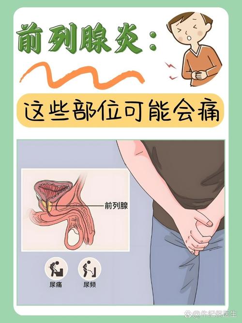 前列腺炎：男性健康“腺”制的背后推手