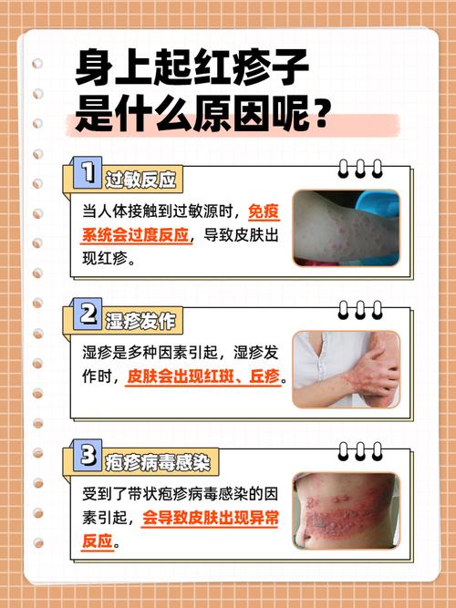探秘过敏症：从成因到应对的全方位解读