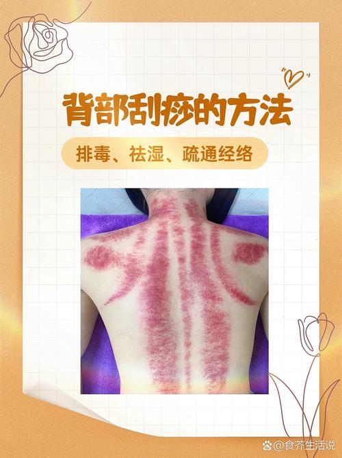 身体刮痧：传统疗法的奥秘与现代应用
